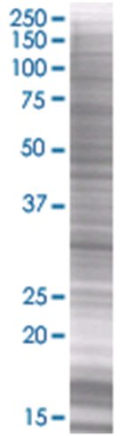 Asb8 293t cell transient overexpres sion lysate (denatured) 100 µl