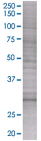 Asb9 293t cell transient overexpres sion lysate (denatured) 100 µl