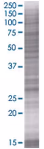 Rab40a 293t cell transient overexpr ession lysate (denatured) 100 µl
