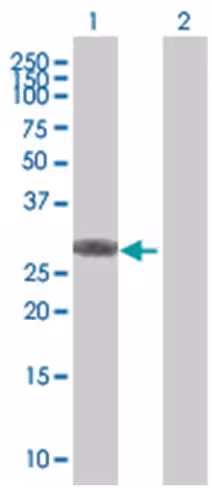 Olig3 293t cell transient overexpre ssion lysate (denatured) 100 µl