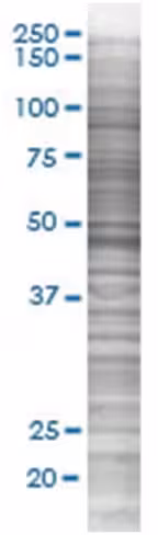 Psrc2 293t cell transient overexpre ssion lysate (denatured) 100 µl