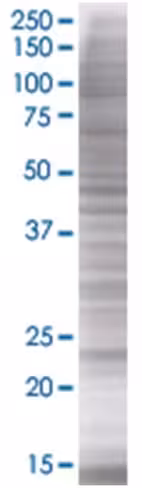 Rab43 293t cell transient overexpre ssion lysate (denatured) 100 µl