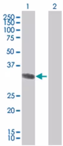 Or6b2 293t cell transient overexpre ssion lysate (denatured) 100 µl