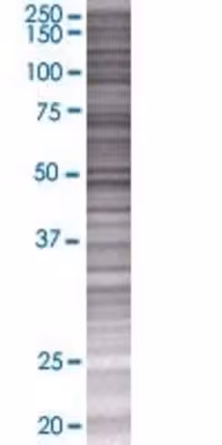 Ptp4a1 293t cell transient overexpr ession lysate (denatured) 100 µl