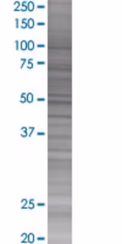 Rab7 293t cell transient overexpres sion lysate (denatured) 100 µl