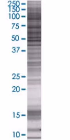 Pdhx 293t cell transient overexpres sion lysate (denatured) 100 µl