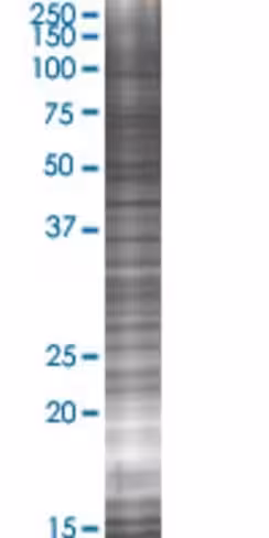 Picalm 293t cell transient overexpr ession lysate (denatured) 100 µl