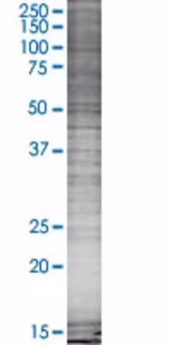 Pip5k2b 293t cell transient overexp ression lysate (denatured) 100 µl