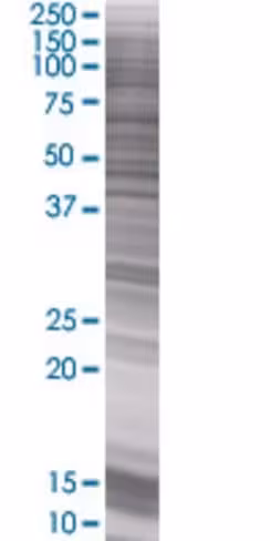 Pla2g10 293t cell transient overexp ression lysate (denatured) 100 µl