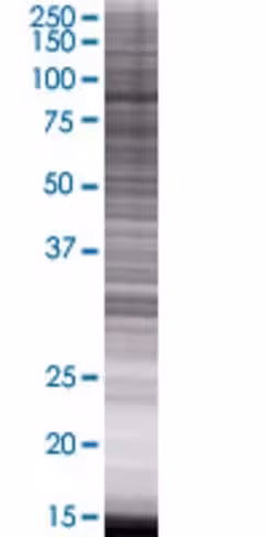 Rasal1 293t cell transient overexpr ession lysate (denatured) 100 µl