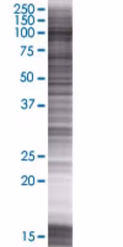 Ppfibp2 293t cell transient overexp ression lysate (denatured) 100 µl