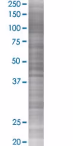 Ppfibp2 293t cell transient overexp ression lysate (denatured) 100 µl