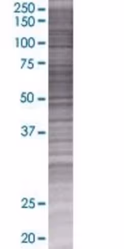 Pex3 293t cell transient overexpres sion lysate (denatured) 100 µl