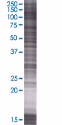 Parg 293t cell transient overexpres sion lysate (denatured) 100 µl