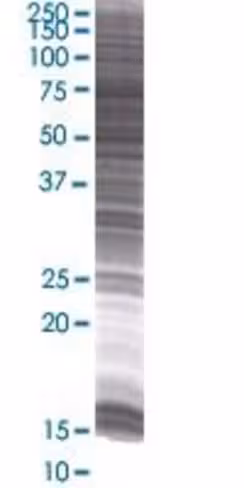 Pias1 293t cell transient overexpre ssion lysate (denatured) 100 µl