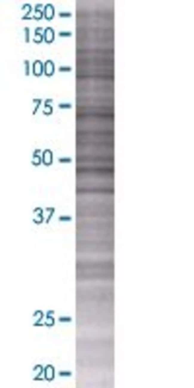 Prpf18 293t cell transient overexpr ession lysate (denatured) 100 µl