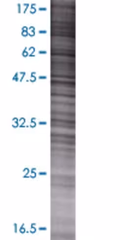 Pdxk 293t cell transient overexpres sion lysate (denatured) 100 µl