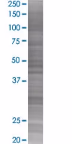 Prkra 293t cell transient overexpre ssion lysate (denatured) 100 µl