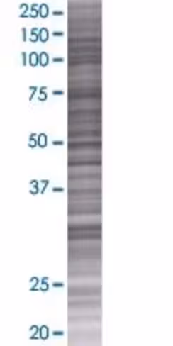 Ppap2a 293t cell transient overexpr ession lysate (denatured) 100 µl