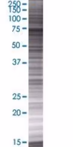 Pabpc4 293t cell transient overexpr ession lysate (denatured) 100 µl