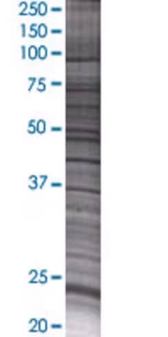 Rab11a 293t cell transient overexpr ession lysate (denatured) 100 µl