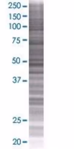 Proz 293t cell transient overexpres sion lysate (denatured) 100 µl