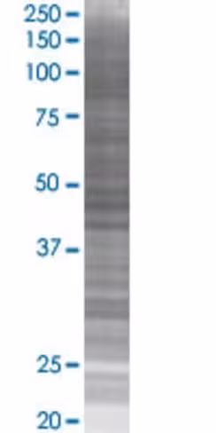Proz 293t cell transient overexpres sion lysate (denatured) 100 µl