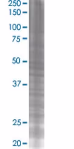 Rab7l1 293t cell transient overexpr ession lysate (denatured) 100 µl