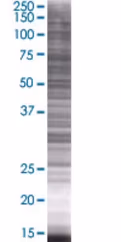 Artn 293t cell transient overexpres sion lysate (denatured) 100 µl