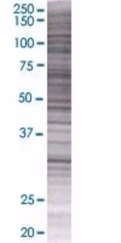 Pstpip2 293t cell transient overexp ression lysate (denatured) 100 µl