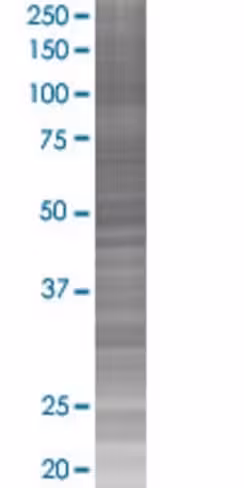 Papss2 293t cell transient overexpr ession lysate (denatured) 100 µl