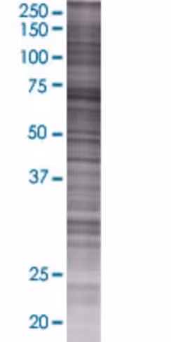 Pias2 293t cell transient overexpre ssion lysate (denatured) 100 µl