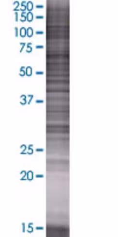 Pdlim1 293t cell transient overexpr ession lysate (denatured) 100 µl
