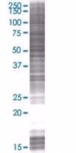 Prpf4 293t cell transient overexpre ssion lysate (denatured) 100 µl