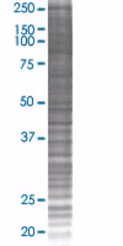 Pdcd5 293t cell transient overexpre ssion lysate (denatured) 100 µl