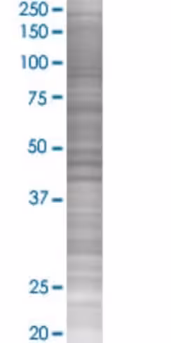 Pttg1 293t cell transient overexpre ssion lysate (denatured) 100 µl