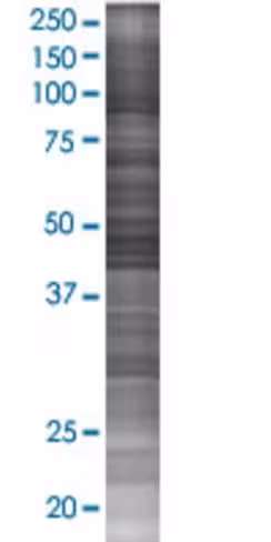 Pscd2 293t cell transient overexpre ssion lysate (denatured) 100 µl
