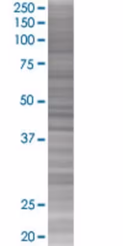 Prss15 293t cell transient overexpr ession lysate (denatured) 100 µl
