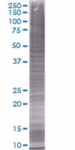 Rab28 293t cell transient overexpre ssion lysate(denatured) 100 µl
