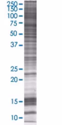 Rab9a 293t cell transient overexpre ssion lysate (denatured) 100 µl