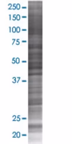 Rab9a 293t cell transient overexpre ssion lysate (denatured) 100 µl