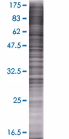 Ppt2 293t cell transient overexpres sion lysate (denatured) 100 µl