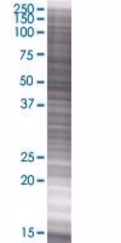 Prepl 293t cell transient overexpre ssion lysate (denatured) 100 µl