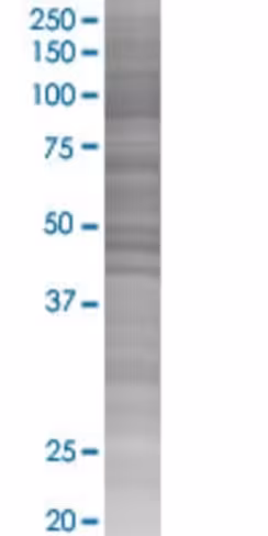 Rbm39 293t cell transient overexpre ssion lysate (denatured) 100 µl
