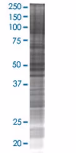 Ppm1f 293t cell transient overexpre ssion lysate (denatured) 100 µl