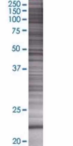 Pde4dip 293t cell transient overexp ression lysate (denatured) 100 µl