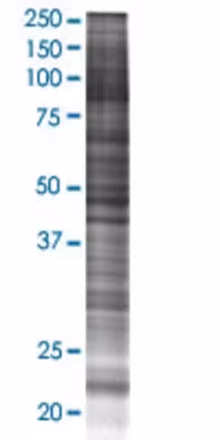Pde4dip 293t cell transient overexp ression lysate (denatured) 100 µl