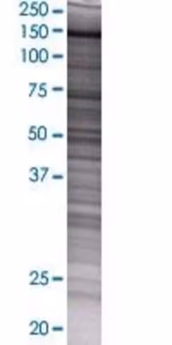 Pum1 293t cell transient overexpres sion lysate (denatured) 100 µl