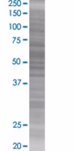 Rapgef5 293t cell transient overexp ression lysate (denatured) 100 µl