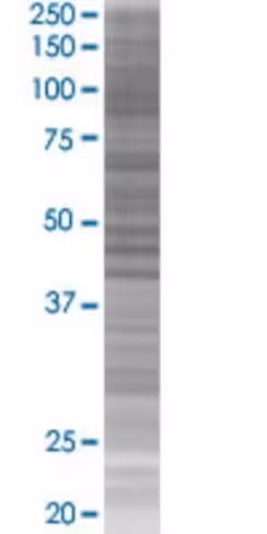 Psmd6 293t cell transient overexpre ssion lysate (denatured) 100 µl